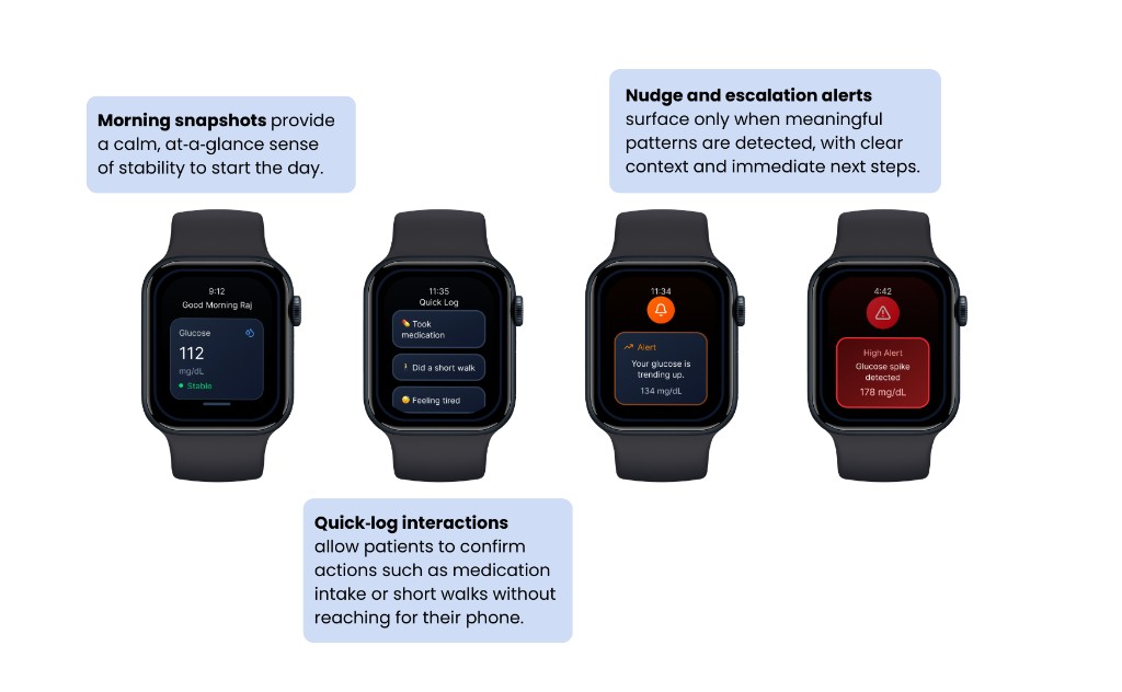 Four Apple Watch screens: morning glucose snapshot, quick log actions, glucose nudge alert, and high escalation alert